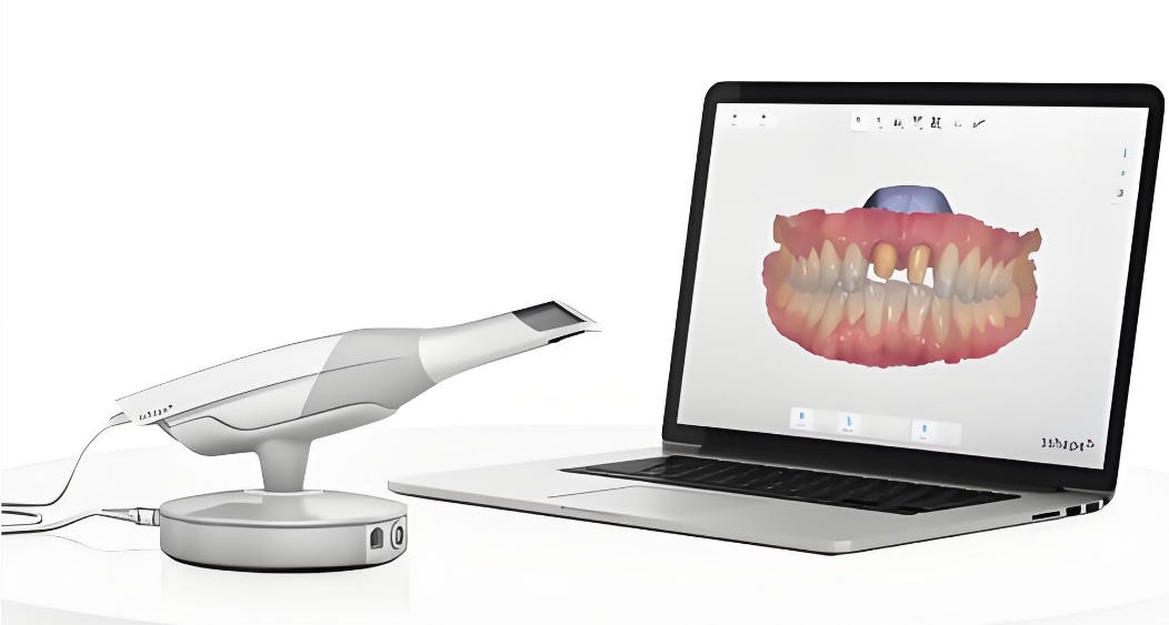 濾光片 三維口內(nèi)掃描儀