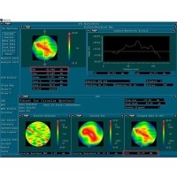 光學(xué)鏡片面形解析--從設(shè)計(jì)形狀到精度參數(shù)PV與RMS